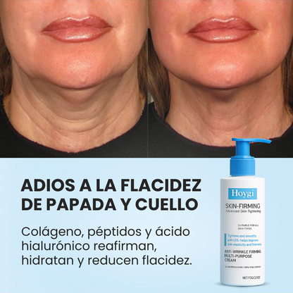 Hoygi® SkinFirm Reafirmante Facial Intenso