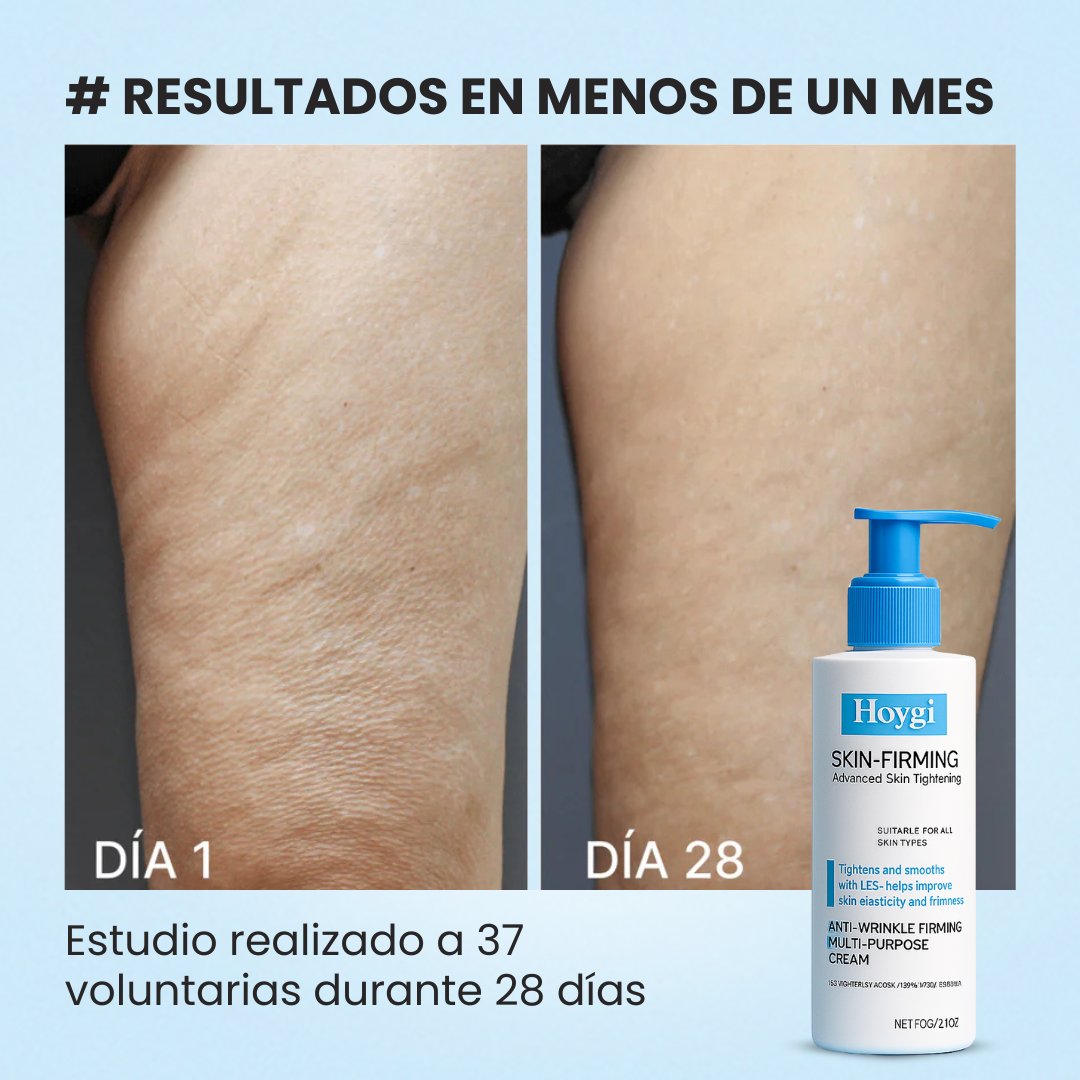 Hoygi® Reafirmante Corporal Profesional